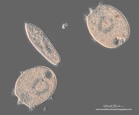  Didinium: Un Prédateur Microscopique à l’Affût Constant!